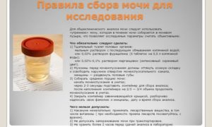 Почему анализ мочи сдают утром