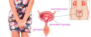 Почему болит уретра у женщин