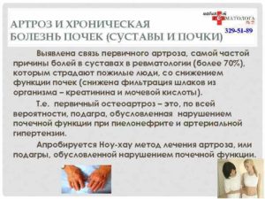 Почки суставы связь