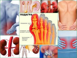 Почки суставы связь