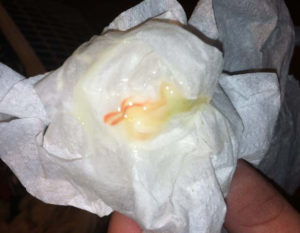 После родов моча пахнет