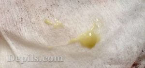 После родов моча пахнет