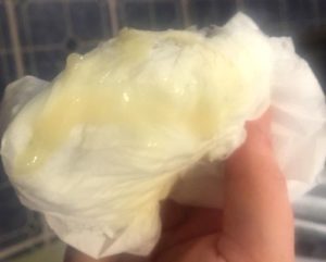 После родов моча пахнет