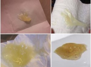 После родов моча пахнет