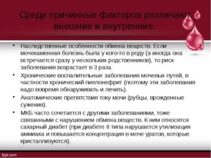 Презентация на тему мочекаменная болезнь