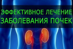 При воспаление почек какие симптомы и как нужно лечить