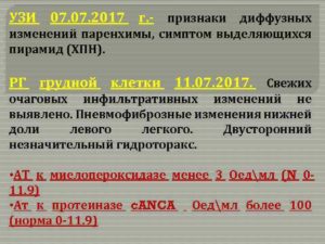 Признаки диффузных изменений паренхимы