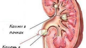 Протоки в почках