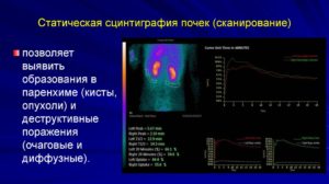 Сцинтиграфия почек противопоказания