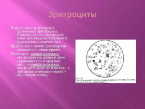 В моче 4 6 эритроциты в