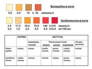 Уробилиноген в моче 34
