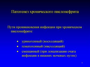 Восходящий путь инфицирования при пиелонефрите