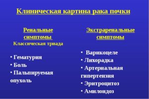 Триада симптомов рака почки