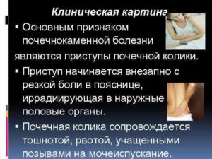 Тошнота при болях в почках