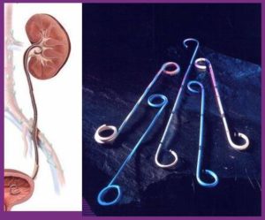 Стенд при почках