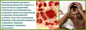 Стрептококковый уретрит у мужчин