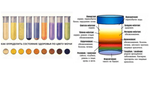 Светлая моча при каких заболеваниях почек