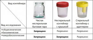 Сколько миллилитров мочи нужно для анализа общего