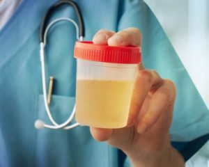 Сколько времени можно хранить мочу для анализа