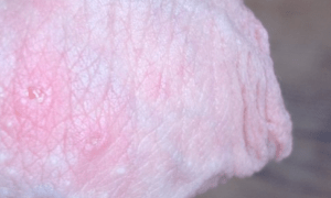 Зуд в канале члена