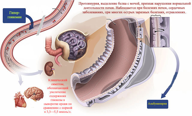 Альбуминария